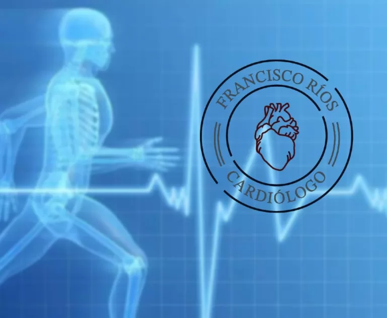 Actividad Fisica, Cardiologo en Tijuana