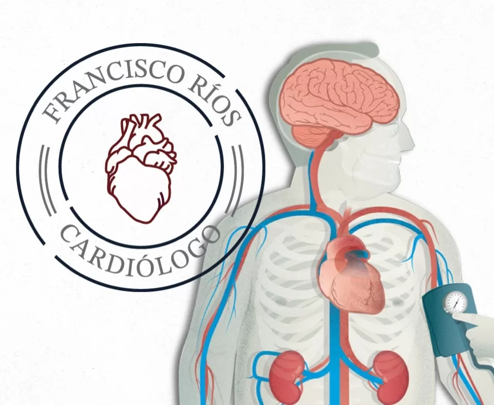 ¿Qué es la hipertensión arterial? Cardiólogo en Tijuana